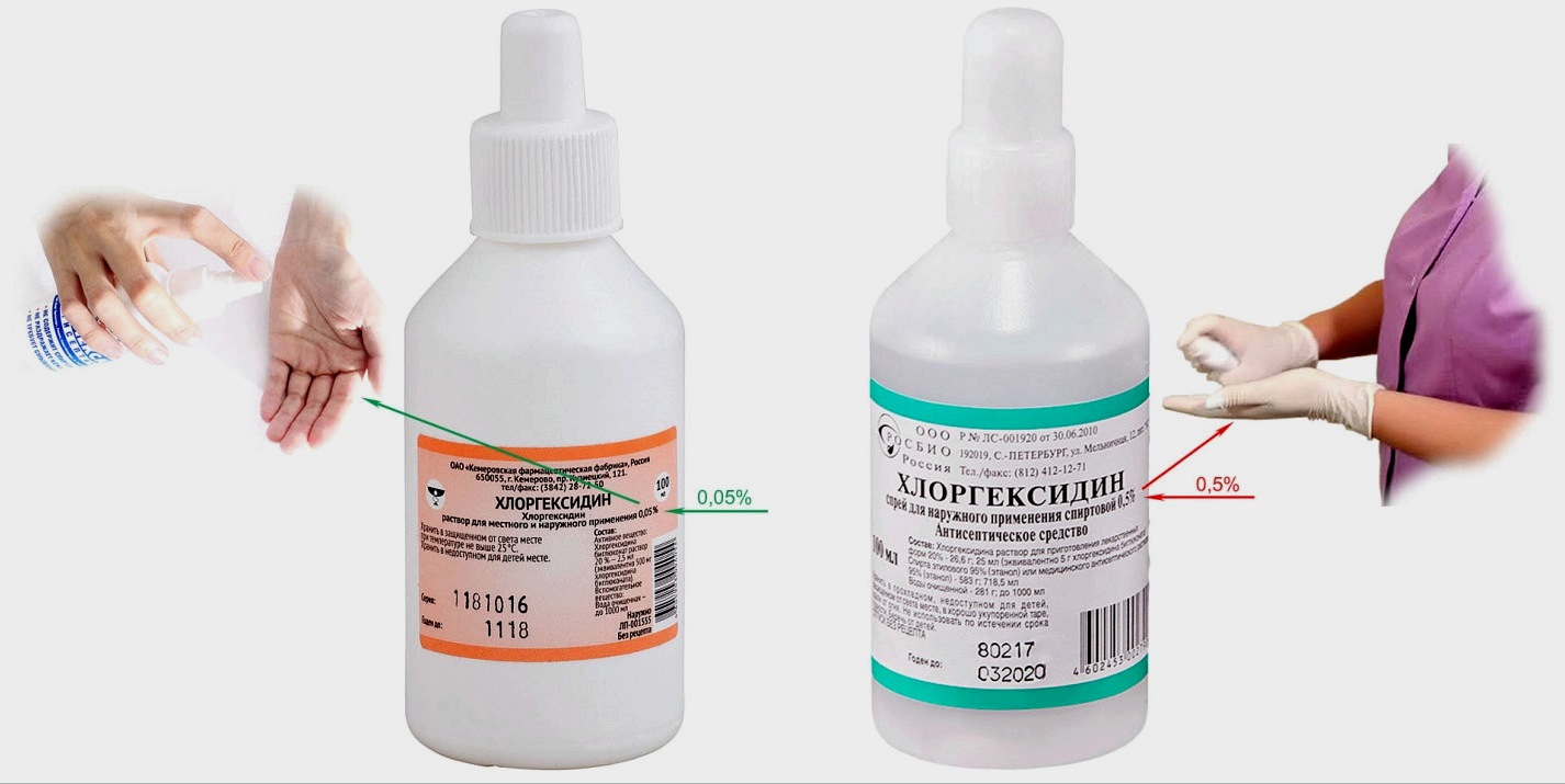 Antiszeptikumok (fertőtlenítők) kézre és felületekre: termékek és receptek áttekintése a hatékonyság értékelésével